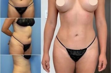 The Ultimate List of Traits of the Best Body Contouring Surgeon in Dubai
